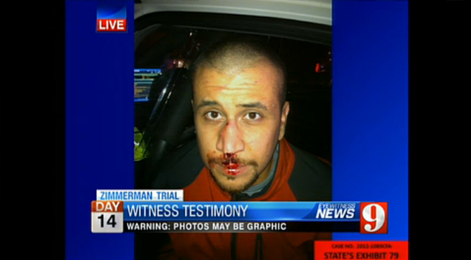 George Zimmerman, minutes after being attacked by Trayvon Martin