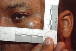 Rico Gray's injuries following beating by Marissa Alexander