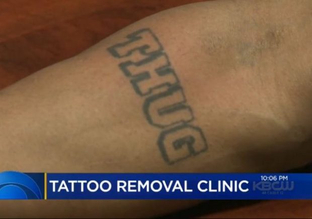 Trump Immigration Enforcement Spurs Gang Tattoo Removal Boom